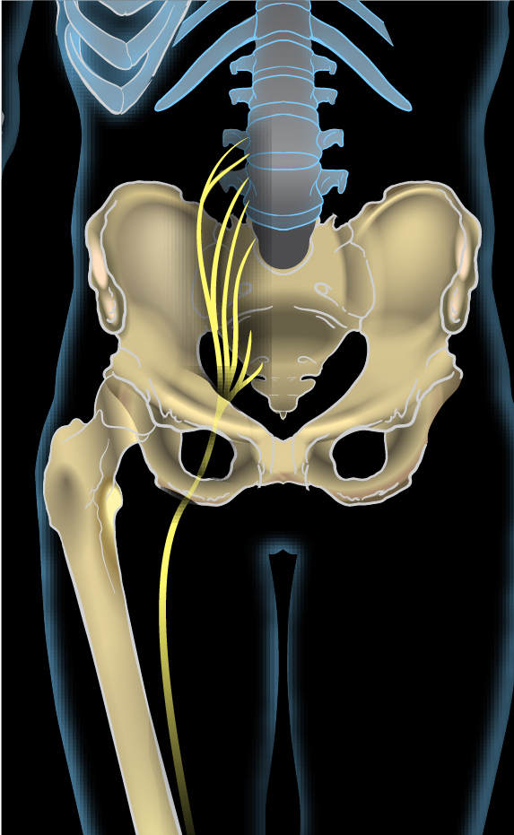 Sciatica, Rockville MD